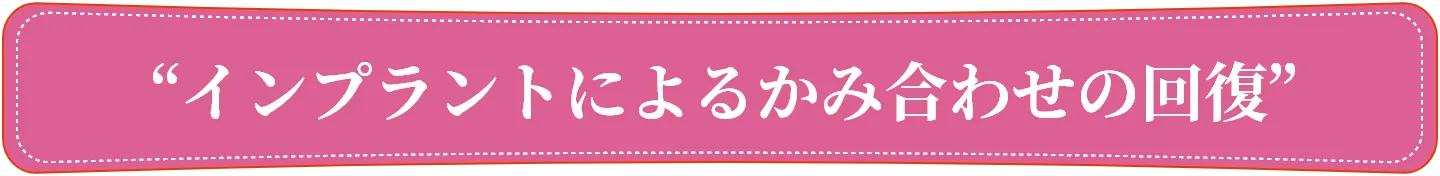 インプラントによるかみ合わせの回復