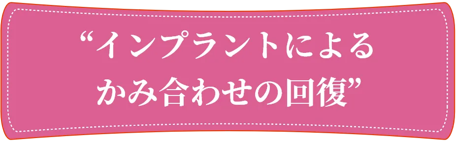 インプラントによるかみ合わせの回復