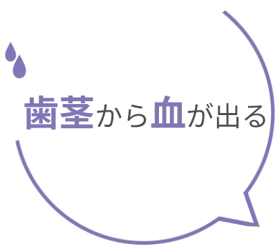 以前いれた被せ物の色が気になる